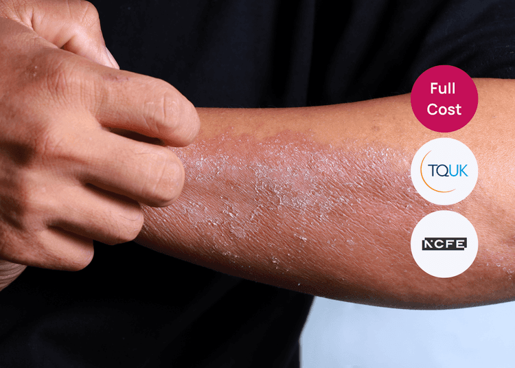 Close up of a person scratching a dry, irritated patch on their forearm related to allergy awareness.